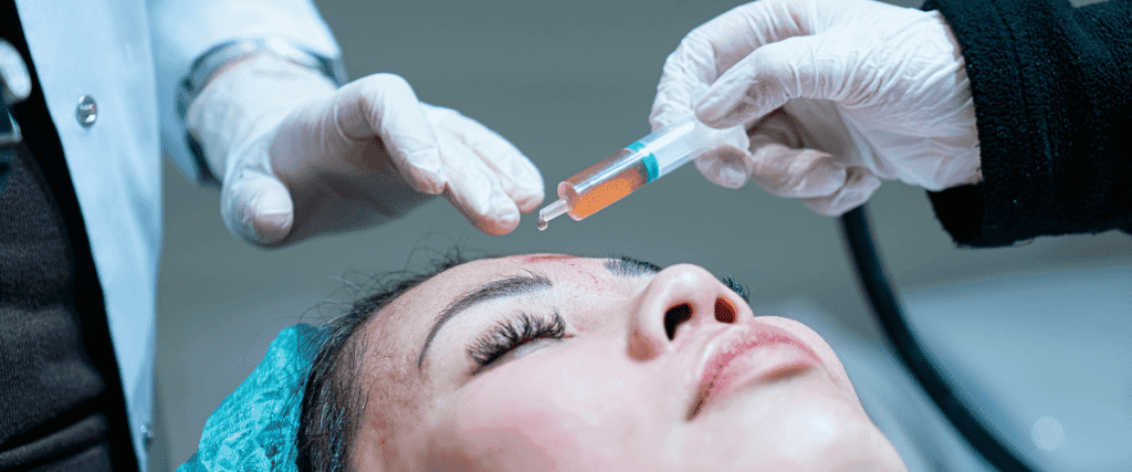 Microneedling with PRP (platelet rich plasma)
vampire facial near me